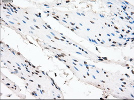 CRYAB / Alpha B Crystallin Antibody - IHC of paraffin-embedded bladder tissue using anti-CRYAB mouse monoclonal antibody. (Dilution 1:50).