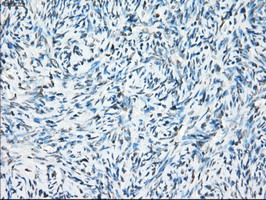 CRYAB / Alpha B Crystallin Antibody - IHC of paraffin-embedded Ovary tissue using anti-CRYAB mouse monoclonal antibody. (Dilution 1:50).