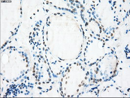 CRYAB / Alpha B Crystallin Antibody - IHC of paraffin-embedded thyroid tissue using anti-CRYAB mouse monoclonal antibody. (Dilution 1:50).