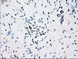 CRYAB / Alpha B Crystallin Antibody - IHC of paraffin-embedded prostate tissue using anti-CRYAB mouse monoclonal antibody. (Dilution 1:50).