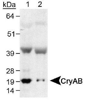 CRYAB / Alpha B Crystallin Antibody - Detection of CryAB using antibody at 0.5 ug/ml. Lane 1: Human skeletal muscle Lane 2: Mouse skeletal muscle.  This image was taken for the unconjugated form of this product. Other forms have not been tested.