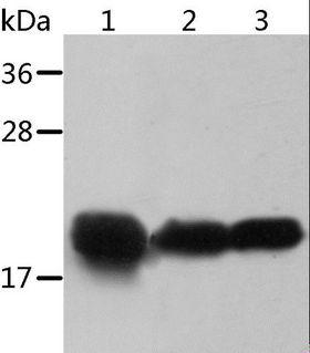 CRYAB / Alpha B Crystallin Antibody - Western blot analysis of Mouse heart and human chromaffin cell tumor tissue, mouse muscle tissue, using CRYAB Polyclonal Antibody at dilution of 1:500.
