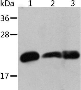 CRYAB / Alpha B Crystallin Antibody - Western blot analysis of Mouse heart and human chromaffin cell tumor tissue, mouse muscle tissue, using CRYAB Polyclonal Antibody at dilution of 1:500.