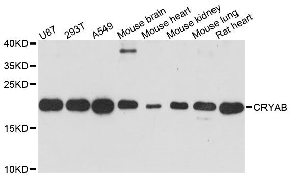 CRYAB / Alpha B Crystallin Antibody - Western blot analysis of extracts of various cell lines, using CRYAB antibody at 1:3000 dilution. The secondary antibody used was an HRP Goat Anti-Rabbit IgG (H+L) at 1:10000 dilution. Lysates were loaded 25ug per lane and 3% nonfat dry milk in TBST was used for blocking. An ECL Kit was used for detection and the exposure time was 60s.