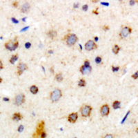 CRYAB / Alpha B Crystallin Antibody - Immunohistochemical analysis of Alpha-crystallin B staining in human brain formalin fixed paraffin embedded tissue section. The section was pre-treated using heat mediated antigen retrieval with sodium citrate buffer (pH 6.0). The section was then incubated with the antibody at room temperature and detected using an HRP conjugated compact polymer system. DAB was used as the chromogen. The section was then counterstained with hematoxylin and mounted with DPX.