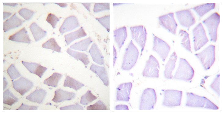 CRYAB / Alpha B Crystallin Antibody - Immunohistochemistry analysis of paraffin-embedded human skeletal muscle, using CRYAB (Phospho-Ser19) Antibody. The picture on the right is blocked with the phospho peptide.