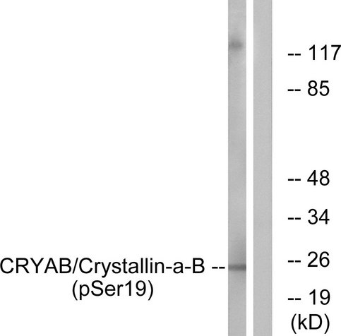 CRYAB / Alpha B Crystallin Antibody - Western blot analysis of lysates from HepG2 cells treated with nocodazole 1ug/ml 16h, using CRYAB (Phospho-Ser19) Antibody. The lane on the right is blocked with the phospho peptide.