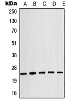 CRYAB / Alpha B Crystallin Antibody - Western blot analysis of Alpha-crystallin B (pS19) expression in MCF7 (A); mouse spleen (B); mouse eye (C); rat liver (D); rat eye (E) whole cell lysates.