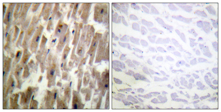 CRYAB / Alpha B Crystallin Antibody - Immunohistochemistry analysis of paraffin-embedded human heart, using CRYAB (Phospho-Ser45) Antibody. The picture on the right is blocked with the phospho peptide.