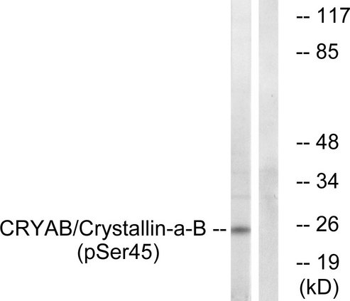CRYAB / Alpha B Crystallin Antibody - Western blot analysis of lysates from COS7 cells treated with anisomycin 25ug/ml 30', using CRYAB (Phospho-Ser45) Antibody. The lane on the right is blocked with the phospho peptide.