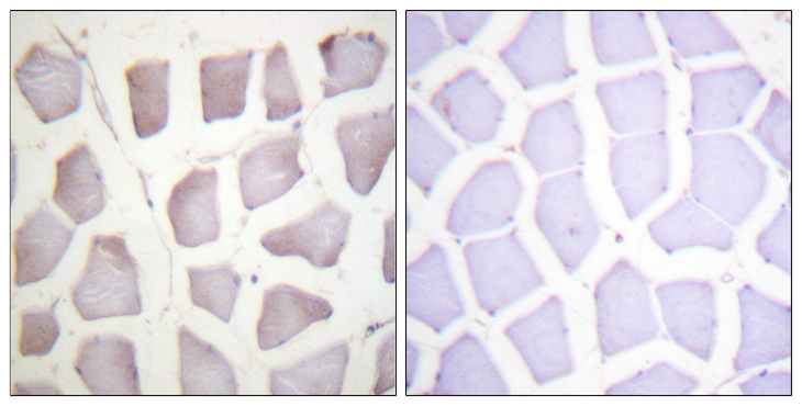 CRYAB / Alpha B Crystallin Antibody - Immunohistochemistry analysis of paraffin-embedded human skeletal muscle, using CRYAB/Crystallin-alpha-B (Phospho-Ser59) Antibody. The picture on the right is blocked with the phospho peptide.