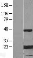 CRYAB / Alpha B Crystallin Protein - Western validation with an anti-DDK antibody * L: Control HEK293 lysate R: Over-expression lysate