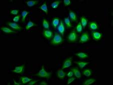 CRYBA1 Antibody - Immunofluorescence staining of A549 cells with CRYBA1 Antibody at 1:100, counter-stained with DAPI. The cells were fixed in 4% formaldehyde, permeabilized using 0.2% Triton X-100 and blocked in 10% normal Goat Serum. The cells were then incubated with the antibody overnight at 4°C. The secondary antibody was Alexa Fluor 488-congugated AffiniPure Goat Anti-Rabbit IgG(H+L).