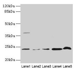 CRYBA1 Antibody - Western blot All lanes: CRYBA1 antibody at 6µg/ml Lane 1: Mouse heart tissue Lane 2: Human placenta tissue Lane 3: U251 whole cell lysate Lane 4: U937 whole cell lysate Lane 5: Mouse stomach tissue Lane 6: Mouse liver tissue Secondary Goat polyclonal to rabbit IgG at 1/10000 dilution Predicted band size: 26, 24 kDa Observed band size: 26 kDa