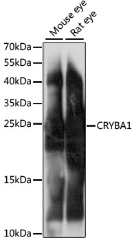 CRYBA1 Antibody - Western blot analysis of extracts of various cell lines, using CRYBA1 antibody at 1:1000 dilution. The secondary antibody used was an HRP Goat Anti-Rabbit IgG (H+L) at 1:10000 dilution. Lysates were loaded 25ug per lane and 3% nonfat dry milk in TBST was used for blocking. An ECL Kit was used for detection and the exposure time was 1s.