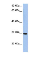 CRYBA1 Antibody - CRYBA1 antibody Western blot of HT1080 cell lysate. This image was taken for the unconjugated form of this product. Other forms have not been tested.
