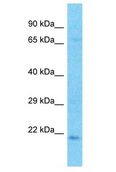 CRYBA2 Antibody - CRYBA2 antibody Western Blot of U937. Antibody dilution: 1 ug/ml.  This image was taken for the unconjugated form of this product. Other forms have not been tested.