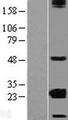 CRYBA2 Protein - Western validation with an anti-DDK antibody * L: Control HEK293 lysate R: Over-expression lysate