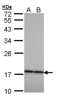 CRYBA4 Antibody - Sample (30 ug of whole cell lysate). A: H1299, B: HeLa. 12% SDS PAGE. CRYBA4 antibody diluted at 1:1000