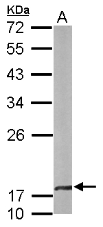CRYBA4 Antibody - Sample (50 ug of whole cell lysate). A: mouse brain. 12% SDS PAGE. CRYBA4 antibody diluted at 1:1000.