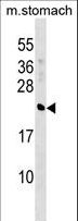 CRYBA4 Antibody - CRYBA4 Antibody western blot of mouse stomach tissue lysates (35 ug/lane). The CRYBA4 antibody detected the CRYBA4 protein (arrow).