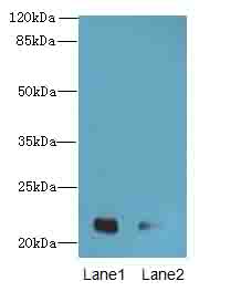 CRYBA4 Antibody - Western blot. All lanes: CRYBA4 antibody at 0.1 ug/ml. Lane 1: HeLa whole cell lysate. Lane 2: Human placenta tissue. Secondary Goat polyclonal to Rabbit IgG at 1:10000 dilution. Predicted band size: 22 kDa. Observed band size: 22 kDa.