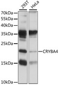 CRYBA4 Antibody - Western blot analysis of extracts of various cell lines, using CRYBA4 antibody at 1:1000 dilution. The secondary antibody used was an HRP Goat Anti-Rabbit IgG (H+L) at 1:10000 dilution. Lysates were loaded 25ug per lane and 3% nonfat dry milk in TBST was used for blocking. An ECL Kit was used for detection and the exposure time was 30S.