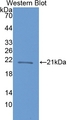 CRYBB1 Antibody