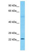 CRYBB1 Antibody - CRYBB1 antibody Western Blot of Fetal Kidney. Antibody dilution: 1 ug/ml.  This image was taken for the unconjugated form of this product. Other forms have not been tested.