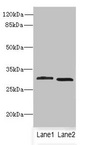 CRYBB1 Antibody - Western blot All Lanes: CRYBB1 antibody at 1.58ug/ml Lane 1 : MCF7 whole cell lysate Lane 2 : Mouse kidney tissue Secondary Goat polyclonal to Rabbit IgG at 1/10000 dilution Predicted band size: 28 kDa Observed band size: 28 kDa