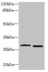 CRYBB1 Antibody - Western blot All lanes: CRYBB1 antibody at 1.58µg/ml Lane 1: MCF-7 whole cell lysate Lane 2: Mouse kidney tissue Secondary Goat polyclonal to rabbit IgG at 1/10000 dilution Predicted band size: 28 kDa Observed band size: 28 kDa
