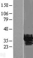 CRYBB1 Protein - Western validation with an anti-DDK antibody * L: Control HEK293 lysate R: Over-expression lysate
