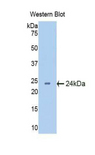 CRYBB2 Antibody - Western blot of recombinant CRYBB2.  This image was taken for the unconjugated form of this product. Other forms have not been tested.