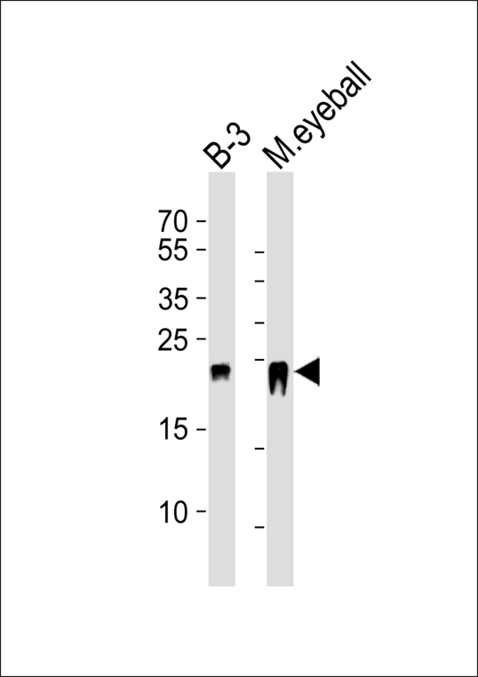 CRYBB2 Antibody - Western blot of lysates from B-3 cell line and mouse eyeball tissue lysate (from left to right) with CRYBB2 Antibody. Antibody was diluted at 1:1000 at each lane. A goat anti-rabbit IgG H&L (HRP) at 1:5000 dilution was used as the secondary antibody. Lysates at 35 ug per lane.