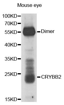 CRYBB2 Antibody - Western blot analysis of extracts of mouse eye.