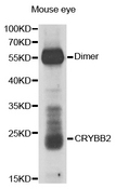 CRYBB2 Antibody - Western blot analysis of extracts of mouse eye.