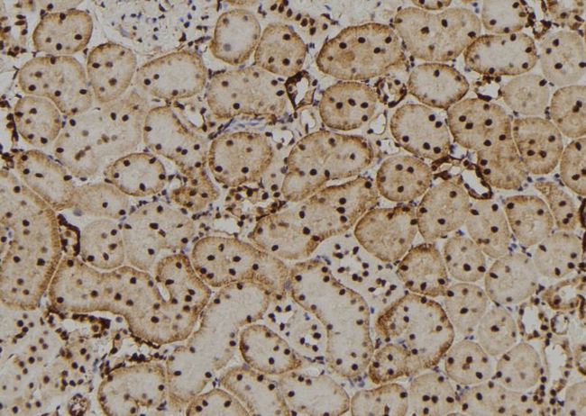 CRYBB2 Antibody - 1:100 staining rat kidney tissue by IHC-P. The sample was formaldehyde fixed and a heat mediated antigen retrieval step in citrate buffer was performed. The sample was then blocked and incubated with the antibody for 1.5 hours at 22°C. An HRP conjugated goat anti-rabbit antibody was used as the secondary.