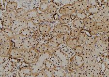 CRYBB2 Antibody - 1:100 staining rat kidney tissue by IHC-P. The sample was formaldehyde fixed and a heat mediated antigen retrieval step in citrate buffer was performed. The sample was then blocked and incubated with the antibody for 1.5 hours at 22°C. An HRP conjugated goat anti-rabbit antibody was used as the secondary.
