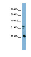 CRYBB3 Antibody - CRYBB3 antibody Western blot of HT1080 cell lysate. This image was taken for the unconjugated form of this product. Other forms have not been tested.