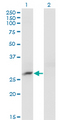 CRYBB3 Antibody - Western Blot analysis of CRYBB3 expression in transfected 293T cell line by CRYBB3 monoclonal antibody (M01), clone 4H6.Lane 1: CRYBB3 transfected lysate (Predicted MW: 24.2 KDa).Lane 2: Non-transfected lysate.