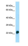 CRYGA Antibody - CRYGA antibody Western Blot of HCT15.  This image was taken for the unconjugated form of this product. Other forms have not been tested.