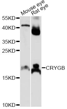 CRYGB Antibody - Western blot analysis of extracts of various cell lines, using CRYGB antibody at 1:1000 dilution. The secondary antibody used was an HRP Goat Anti-Rabbit IgG (H+L) at 1:10000 dilution. Lysates were loaded 25ug per lane and 3% nonfat dry milk in TBST was used for blocking. An ECL Kit was used for detection and the exposure time was 10s.