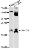 CRYGB Antibody - Western blot analysis of extracts of various cell lines, using CRYGB antibody at 1:1000 dilution. The secondary antibody used was an HRP Goat Anti-Rabbit IgG (H+L) at 1:10000 dilution. Lysates were loaded 25ug per lane and 3% nonfat dry milk in TBST was used for blocking. An ECL Kit was used for detection and the exposure time was 10s.
