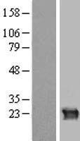 CRYGB Protein - Western validation with an anti-DDK antibody * L: Control HEK293 lysate R: Over-expression lysate