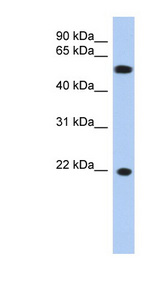 CRYGC / CCL Antibody - CRYGC antibody Western blot of OVCAR-3 cell lysate. This image was taken for the unconjugated form of this product. Other forms have not been tested.