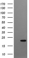 CRYGC / CCL Antibody - HEK293T cells were transfected with the pCMV6-ENTRY control (Left lane) or pCMV6-ENTRY CRYGC (Right lane) cDNA for 48 hrs and lysed. Equivalent amounts of cell lysates (5 ug per lane) were separated by SDS-PAGE and immunoblotted with anti-CRYGC.