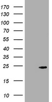 CRYGC / CCL Antibody - HEK293T cells were transfected with the pCMV6-ENTRY control (Left lane) or pCMV6-ENTRY CRYGC (Right lane) cDNA for 48 hrs and lysed. Equivalent amounts of cell lysates (5 ug per lane) were separated by SDS-PAGE and immunoblotted with anti-CRYGC.