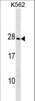 CRYGD / CCP Antibody - CRYGD Antibody western blot of K562 cell line lysates (35 ug/lane). The CRYGD antibody detected the CRYGD protein (arrow).