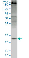 CRYGD / CCP Antibody - CRYGD monoclonal antibody (M03), clone 4E12 Western Blot analysis of CRYGD expression in HepG2.