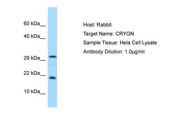 CRYGN Antibody -  This image was taken for the unconjugated form of this product. Other forms have not been tested.